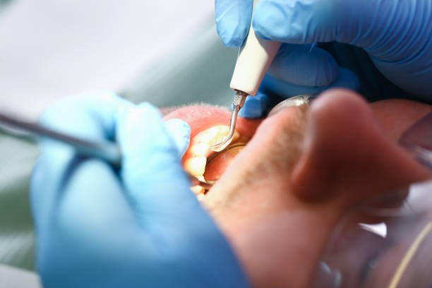 Best Emergency Dentist for Knocked-Out Tooth in Massapequa Park, NY
